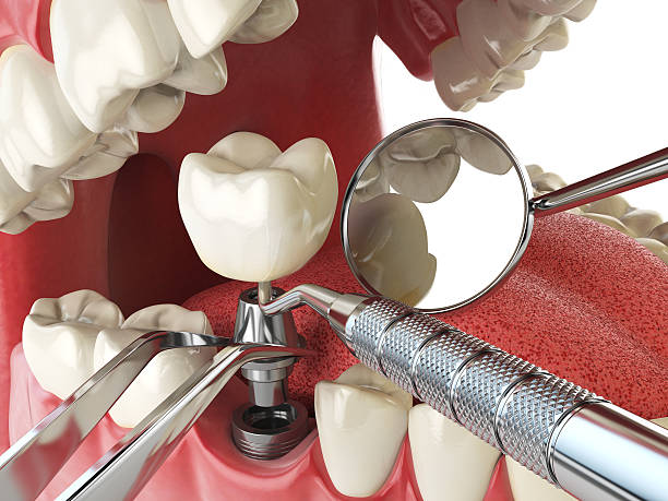 Best Emergency Treatment for Jaw Pain or Injury in Sauk Vlage, IL